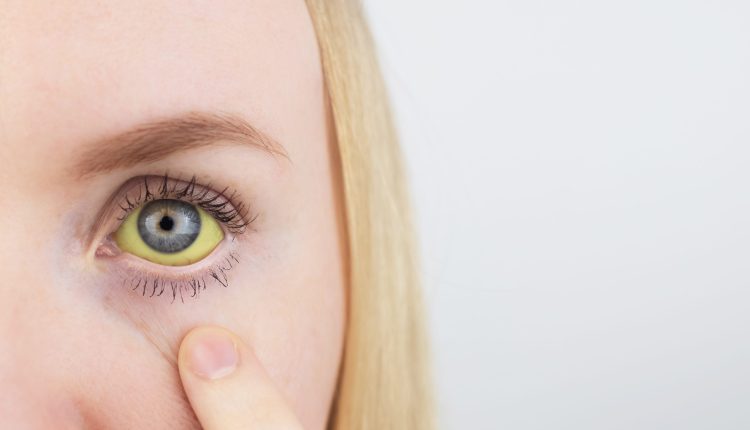 FOT. ALONA SINIEHINA/GETTY IMAGES